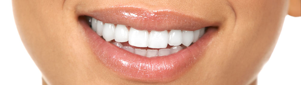 Teeth whitening Dan Dube Dentist Wilmington NC